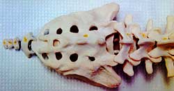 Sacral Vertebrae